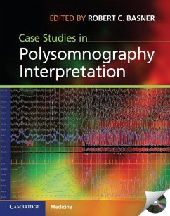 Case Studies in Polysomnography Interpretation (eBook, ePUB)