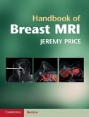 Handbook of Breast MRI (eBook, ePUB)