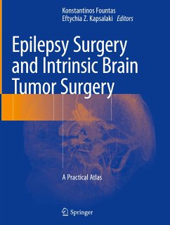 Epilepsy Surgery and Intrinsic Brain Tumor Surgery