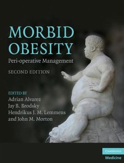 Morbid Obesity (eBook, ePUB)