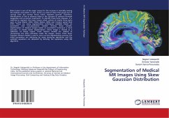 Segmentation of Medical MR Images Using Skew Gaussian Distribution