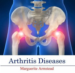 Cover Arthritis Diseases (eBook, PDF)