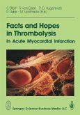 Facts and Hopes in Thrombolysis in Acute Myocardial Infarction (eBook, PDF)