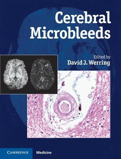 Cover Cerebral Microbleeds (eBook, ePUB)