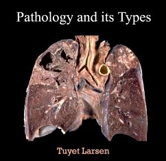 Pathology and its Types (eBook, PDF) - Larsen, Tuyet