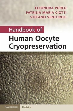 Cover Handbook of Human Oocyte Cryopreservation (eBook, ePUB)