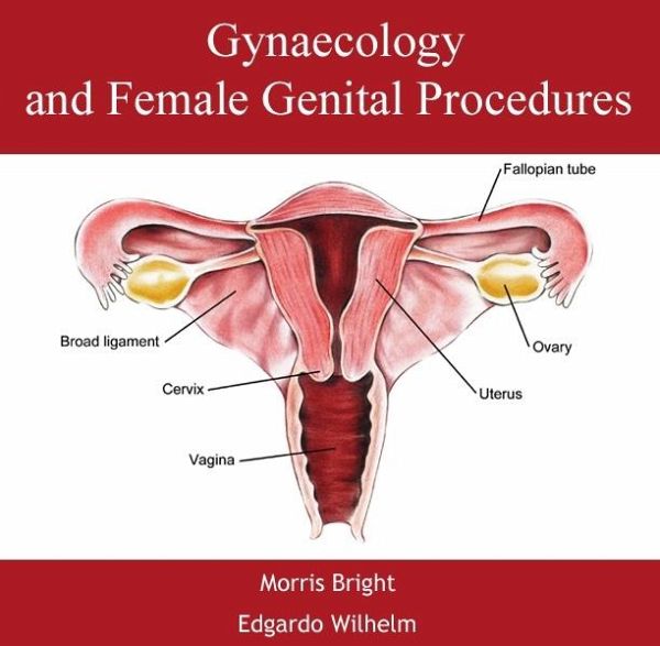Gynaecology and Female Genital Procedures (eBook, PDF) Gynaecology and Female Genital Procedures (eBook, PDF)