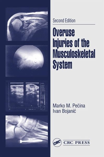 Overuse Injuries of the Musculoskeletal System (eBook, PDF)
