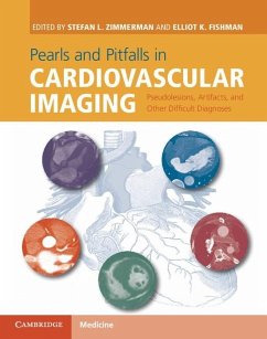 Cover Pearls and Pitfalls in Cardiovascular Imaging (eBook, ePUB)