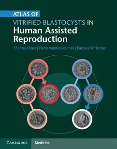 Cover Atlas of Vitrified Blastocysts in Human Assisted Reproduction (eBook, ePUB)