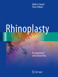 Rhinoplasty (eBook, PDF) - Daniel, Rollin K.; Pálházi, Péter
