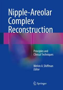 Nipple-Areolar Complex Reconstruction (eBook, PDF)