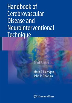 Handbook of Cerebrovascular Disease and Neurointerventional Technique (eBook, PDF) - Harrigan, Mark R.; Deveikis, John P.