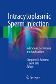Intracytoplasmic Sperm Injection (eBook, PDF)