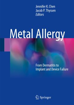 Metal Allergy (eBook, PDF)