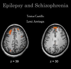 Epilepsy and Schizophrenia (eBook, PDF) - Castillo, Triston Arriaga