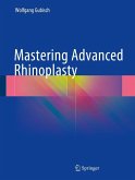 Mastering Advanced Rhinoplasty (eBook, PDF)