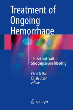 Treatment of Ongoing Hemorrhage (eBook, PDF)