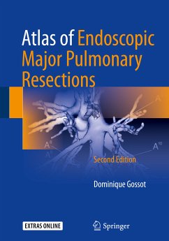 Atlas of Endoscopic Major Pulmonary Resections (eBook, PDF) - Gossot, Dominique