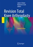 Revision Total Knee Arthroplasty (eBook, PDF)