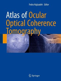 Cover Atlas of Ocular Optical Coherence Tomography (eBook, PDF)