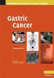 Gastric Cancer (eBook, ePUB) - Bild 1