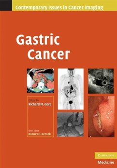 Gastric Cancer (eBook, ePUB)