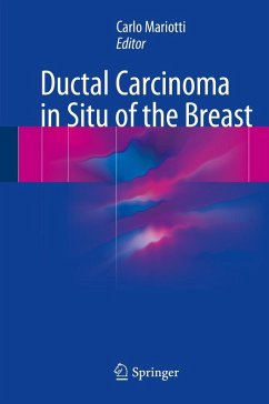 Cover Ductal Carcinoma in Situ of the Breast (eBook, PDF)