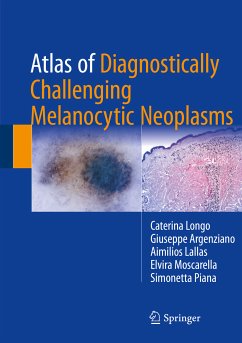 Atlas of Diagnostically Challenging Melanocytic Neoplasms (eBook, PDF) - Longo, Caterina; Argenziano, Giuseppe; Lallas, Aimilios; Moscarella, Elvira; Piana, Simonetta