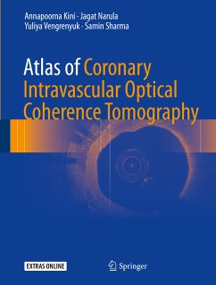 Atlas of Coronary Intravascular Optical Coherence Tomography (eBook, PDF) - Kini, Annapoorna; Narula, Jagat; Vengrenyuk, Yuliya; Sharma, Samin
