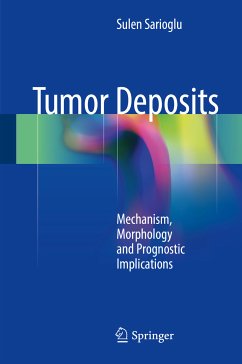 Tumor Deposits (eBook, PDF) - Sarioglu, Sulen