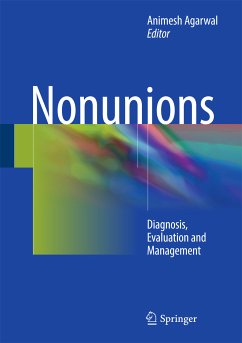 Nonunions (eBook, PDF)