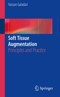 Soft Tissue Augmentation (eBook, PDF) - Galadari, Hassan