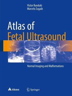 Atlas of Fetal Ultrasound (eBook, PDF) - Bunduki, Victor; Zugaib, Marcelo