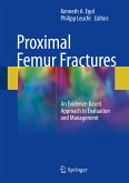 Proximal Femur Fractures (eBook, PDF)