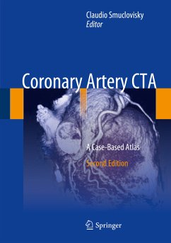 Coronary Artery CTA (eBook, PDF)