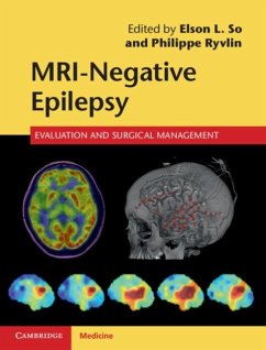 Cover MRI-Negative Epilepsy (eBook, PDF)
