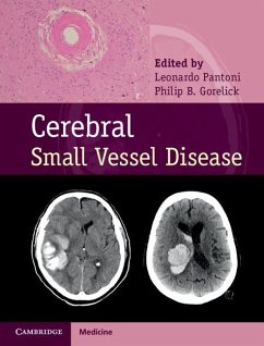 Cover Cerebral Small Vessel Disease (eBook, ePUB)