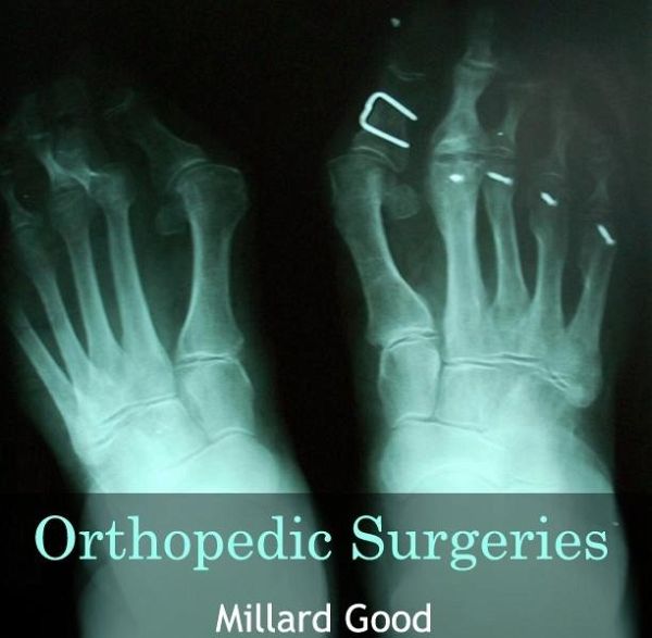 Orthopedic Surgeries (eBook, PDF)