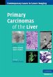 Primary Carcinomas of the Liver (eBook,... - Bild 1