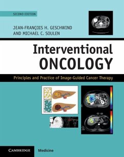 Interventional Oncology (eBook, ePUB)