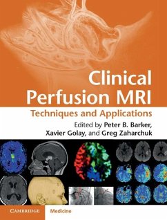 Clinical Perfusion MRI (eBook, ePUB)