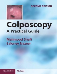 Colposcopy (eBook, ePUB) - Shafi, Mahmood