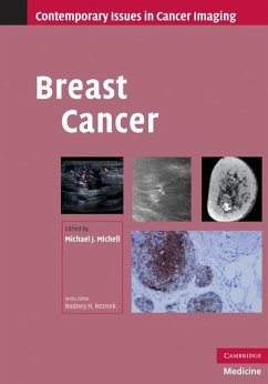 Breast Cancer (eBook, ePUB)