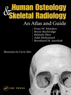Human Osteology and Skeletal Radiology (eBook, PDF) - Matshes, Evan W.; Juurlink, Bernard