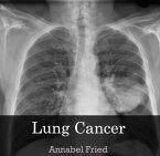 Lung Cancer (eBook, PDF) Lung Cancer (eBook, PDF)