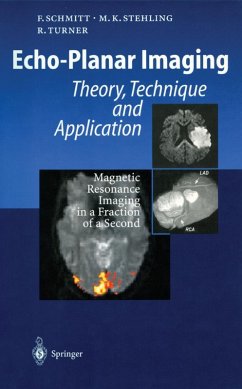Echo-Planar Imaging (eBook, PDF) - Schmitt, Franz; Stehling, Michael K.; Turner, Robert