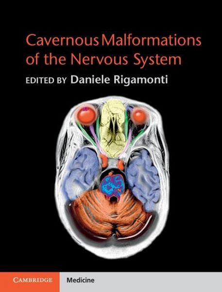Cavernous Malformations of the Nervous System (eBook, ePUB) Cavernous Malformations of the Nervous System (eBook, ePUB)