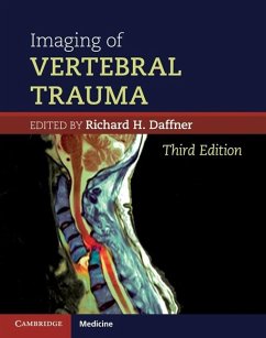 Imaging of Vertebral Trauma (eBook, ePUB) - Daffner, Richard H.