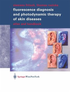 Fluorescence Diagnosis and Photodynamic Therapy of Skin Diseases (eBook, PDF) - Fritsch, Clemens; Ruzicka, Thomas